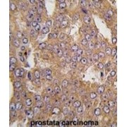 Asparaginyl-tRNA Synthetase 2, Mitochondrial (Putative) (NARS2) Antibody