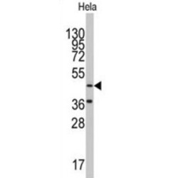 Asparaginyl-tRNA Synthetase 2, Mitochondrial (Putative) (NARS2) Antibody