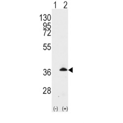Apolipoprotein E (APOE) Antibody