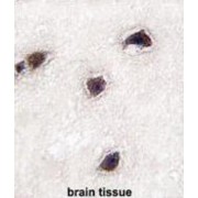 Calcium Binding Protein 1 (CABP1) Antibody