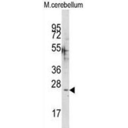 Calcium Binding Protein 1 (CABP1) Antibody