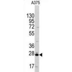 Chloride Intracellular Channel Protein 1 (CLIC1) Antibody