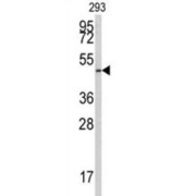 E2F Transcription Factor 1 (E2F1) Antibody