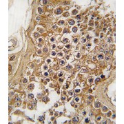 ALK Tyrosine Kinase Receptor (ALK) Antibody