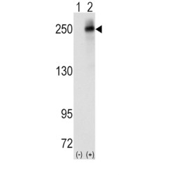 ALK Tyrosine Kinase Receptor (ALK) Antibody