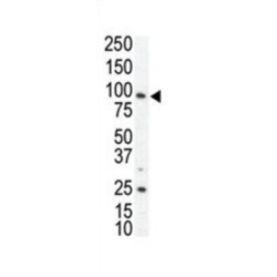 Tyrosine-Protein Kinase Receptor UFO (AXL) Antibody