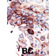 Tyrosine-Protein Kinase Receptor UFO (AXL) Antibody