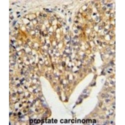 Lumican (LUM) Antibody