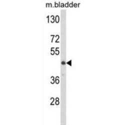 Lumican (LUM) Antibody