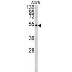 Lumican (LUM) Antibody