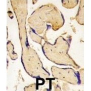 EPH Receptor A3 (EphA3) Antibody
