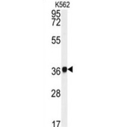 Neutrophil Cytosolic Factor 4 (NCF4) Antibody
