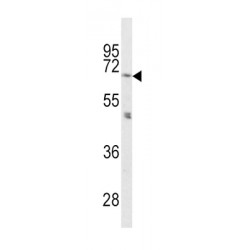 Proprotein Convertase Subtilisin/Kexin Type 2 (PCSK2) Antibody