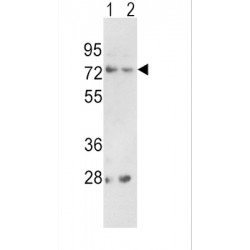 Proprotein Convertase Subtilisin/Kexin Type 2 (PCSK2) Antibody