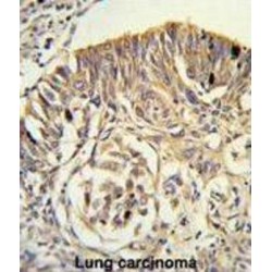 Phospholipid Transfer Protein (PLTP) Antibody