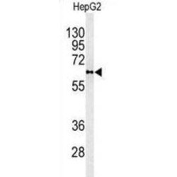 Phospholipid Transfer Protein (PLTP) Antibody