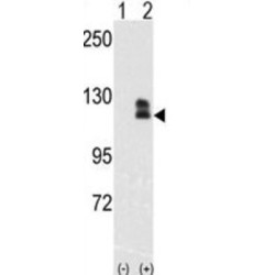 Ephrin Type-B Receptor 2 (EphB2) Antibody