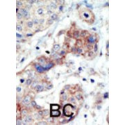 Ephrin Type B Receptor 3 (EphB3) Antibody