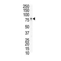 Ephrin Type B Receptor 3 (EphB3) Antibody