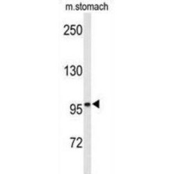 Ephrin Type B Receptor 3 (EphB3) Antibody