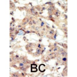 Ephrin Type-B Receptor 6 (EphB6) Antibody