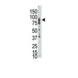 Ephrin Type-B Receptor 6 (EphB6) Antibody