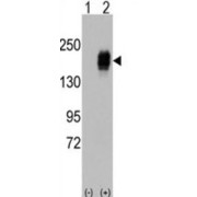 Epidermal Growth Factor Receptor (EGFR) Antibody