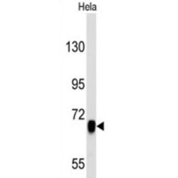 Epidermal Growth Factor Receptor (EGFR) Antibody