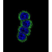 Receptor Tyrosine-Protein Kinase ErbB-2 (ERBB2) Antibody