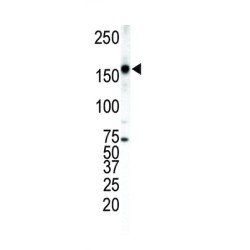 Receptor Tyrosine-Protein Kinase ErbB-4 (ERBB4) Antibody