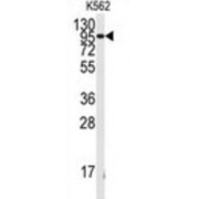 WB analysis of K562 cells.