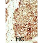 Fibroblast Growth Factor Receptor 2 (FGFR2) Antibody