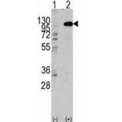 Fibroblast Growth Factor Receptor 2 (FGFR2) Antibody