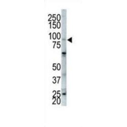 Fibroblast Growth Factor Receptor 2 (FGFR2) Antibody