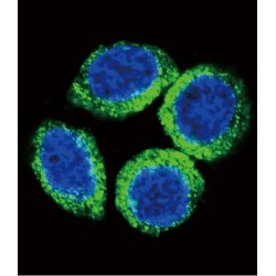 Fibroblast Growth Factor Receptor 2 (FGFR2) Antibody