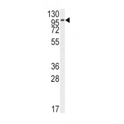 Fibroblast Growth Factor Receptor 2 (FGFR2) Antibody