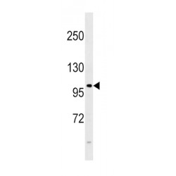 Fibroblast Growth Factor Receptor 4 (FGFR4) Antibody