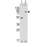 Fibroblast Growth Factor Receptor 4 (FGFR4) Antibody