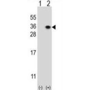 Heparan Sulfate 2-O-Sulfotransferase 1 (HS2ST1) Antibody