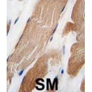 Integrin-Linked Protein Kinase (ILK) Antibody