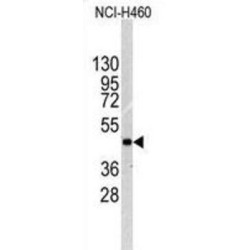 Integrin-Linked Protein Kinase (ILK) Antibody