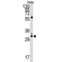 Mercaptopyruvate Sulfurtransferase (MPST) Antibody
