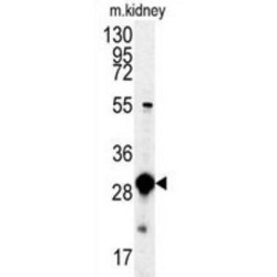 Mercaptopyruvate Sulfurtransferase (MPST) Antibody
