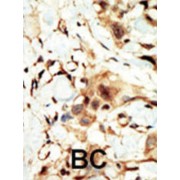 Insulin Receptor (INSR) Antibody