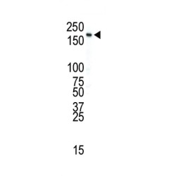 Insulin Receptor (INSR) Antibody