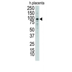 Epithelial Discoidin Domain-Containing Receptor 1 (DDR1) Antibody