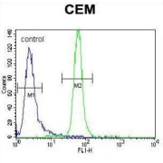 Muscle Skeletal Receptor Tyrosine Kinase (MUSK) Antibody