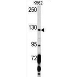 Platelet Derived Growth Factor Receptor Alpha (PDGFRA) Antibody