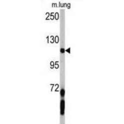 Platelet Derived Growth Factor Receptor Alpha (PDGFRA) Antibody