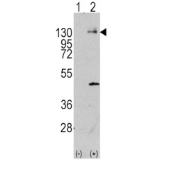 Platelet Derived Growth Factor Receptor Alpha (PDGFRA) Antibody